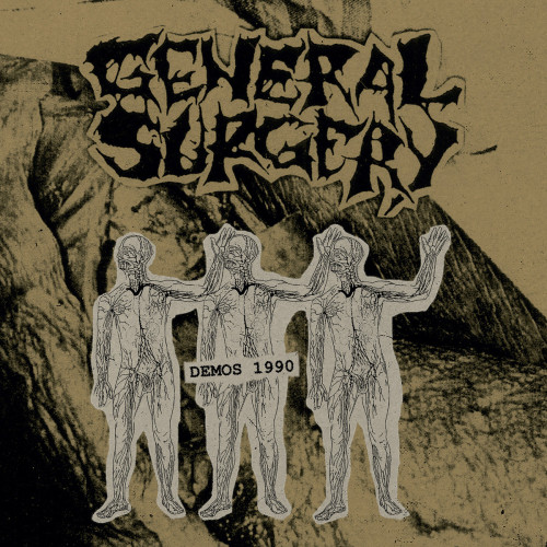 General Surgery – Demos 1990 (Black Vinyl) General Surgery – Demos 1990 (Black Vinyl)