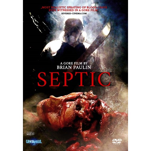 Septic