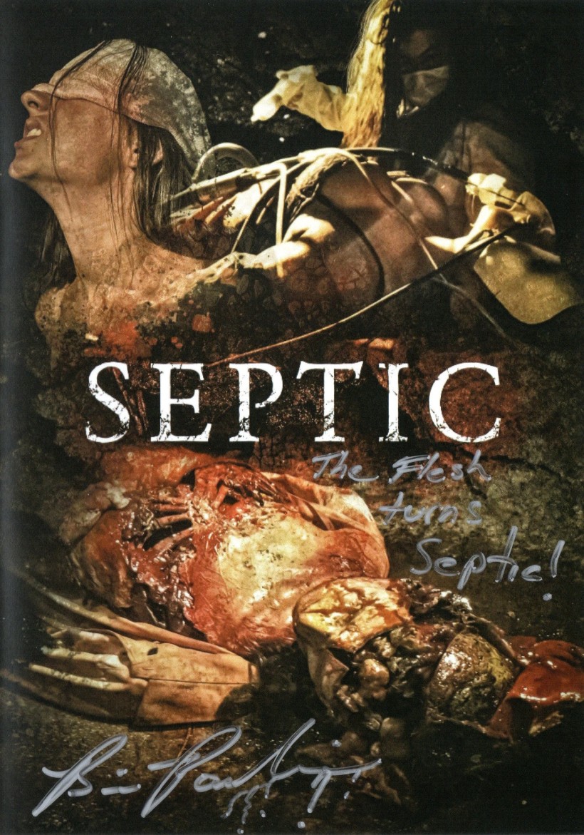 Septic